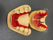 牙齿模型手工制作图片