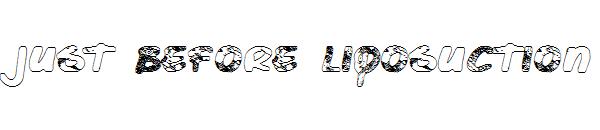 Just Before Liposuction字体